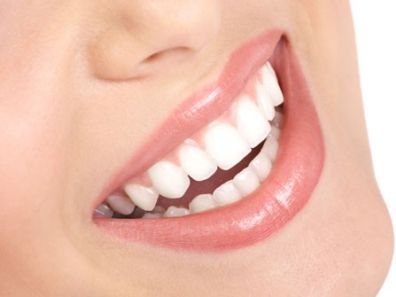 Thin porcelain veneers for an ideal smile