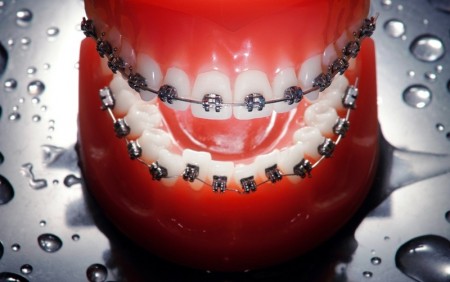 ORTHODONTICS for children or adults - in our clinic!